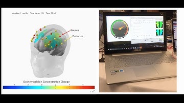 Team "Bright Team" fNIRS Motor Imagery | IEEE SMC Banff 2017 Hackathon