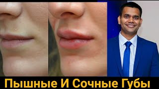 Пухлые И Сочные Губы | Как Восстановить Сухие Губы| Доктор Вивек