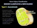 Nerve Injury ,types . Nerve recovery  - Everything You Need To Know - Dr. Nabil Ebraheim
