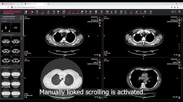 MedDream DICOM Viewer: manually linked scrolling