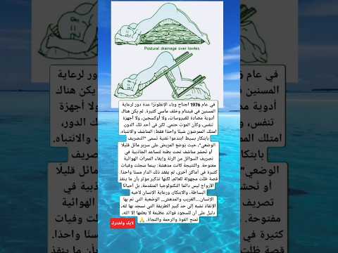 تقنية التصريف الوضعي تساعد الجاذبية في تصريف السوائل من الرئة وإبقاء الممرات الهوائية مفتوح