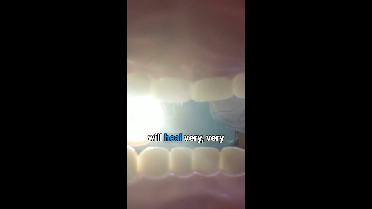 Healing after a tooth extraction