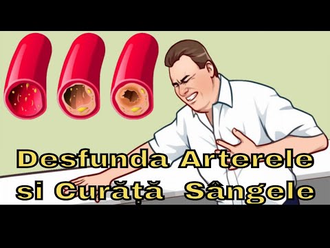 Video: TOP 5 Stațiuni De Sănătate Lângă Moscova Pentru Prevenirea și Tratarea Problemelor Cardiace