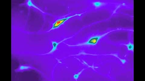 Dynamic calcium activity in human neural progenitor cells