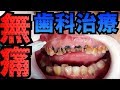 【無痛】歯科治療恐怖症の方のための無痛麻酔[dentistry][ health and wellness][cleaning](針對有齒科治療恐懼癥的患者的無痛麻醉)