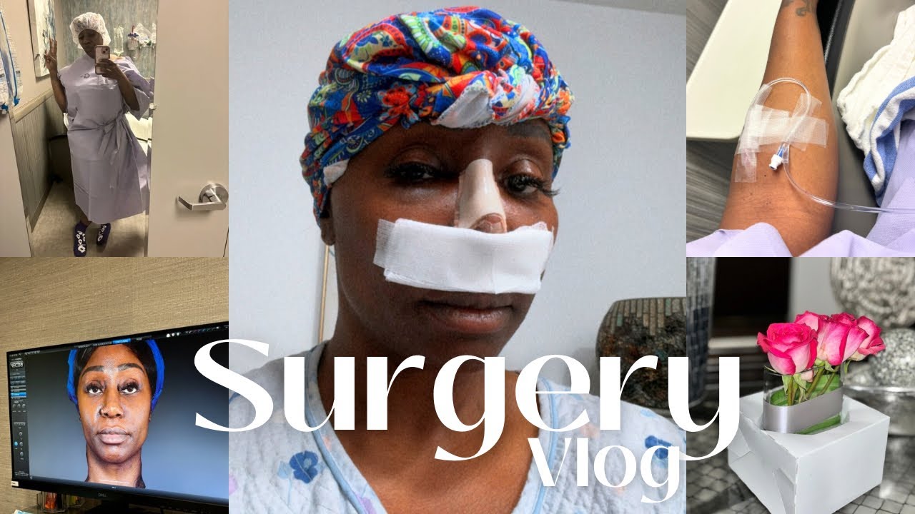 PLASTIC SURGERY • ETHNIC RHINOPLASTY • THE BEST SURGEON IN HOUSTON • FAT GRAFTING • TRANSFORMATION