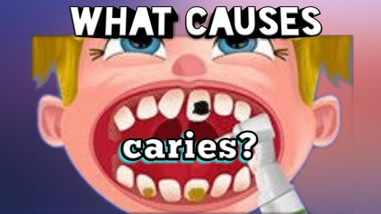 animated video on WHAT CAUSES DENTAL CARIES? YouTube