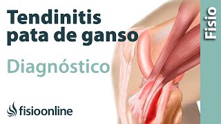 Cómo saber si tengo tendinitis de la pata de ganso