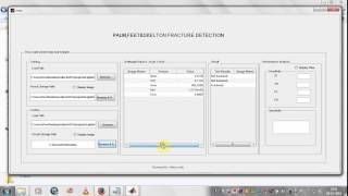 FractureDetection In Bone project VelTech mdu PHNo8438527239 Matlab Projects in Madurai
