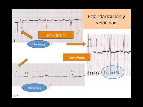 Lectura sistematica del electrocardiograma camera iphone 8 plus apk