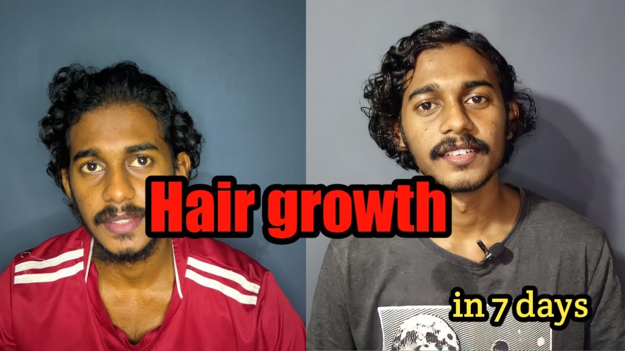 Hair Growth Product Review [Hair Growth Kit Review ] mars by ghc