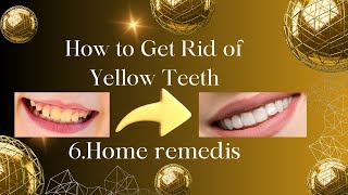 ?how to get teeth whitening..??