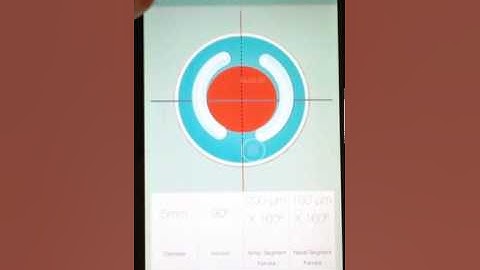 KERATOCONUS EASY FIX Nomograms by Company´s