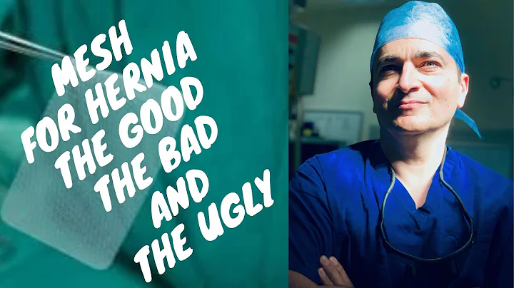 Are hernia mesh safe now? (2023)