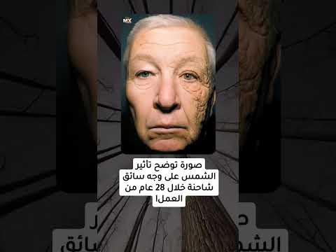صورة توضح تأثير الشمس على وجه سائق شاحنة خلال 28 عام من العمل