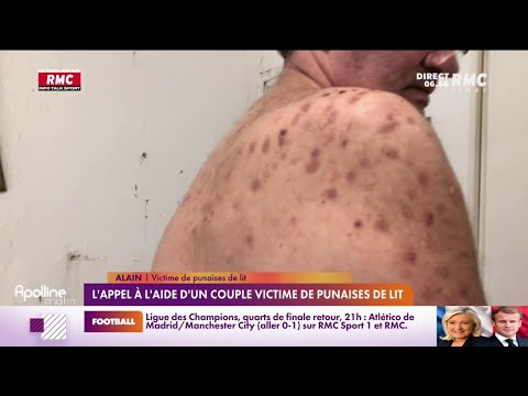 Vidéo: Les puces pondent-elles leurs œufs dans la peau d'un chien?