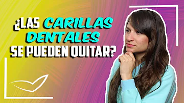 ¿Se pueden quitar las carillas?