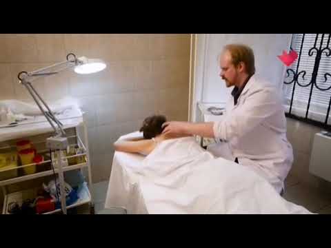 Рефлексотерапия (иглотерапия) в лечении мигрени и головной боли