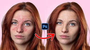 Remove Red Patches from Skin in Photoshop - Photoshop Tricks 2025