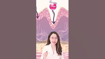 Uống collagen loại nào tốt nhất?