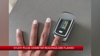 Study: Pulse oximeter readings are flawed, showing bias towards Black skin