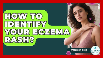 How To Identify Your Eczema Rash? - Eczema Help Hub
