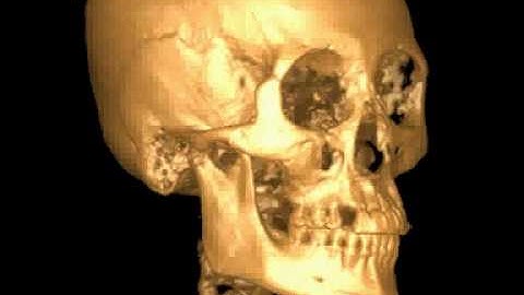 Cone Beam Computed Tomography