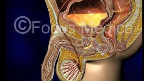 Pathophysiology of OAB - BPH and OAB