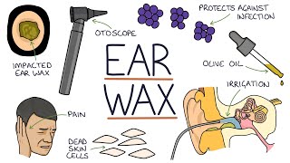 Understanding Ear Wax