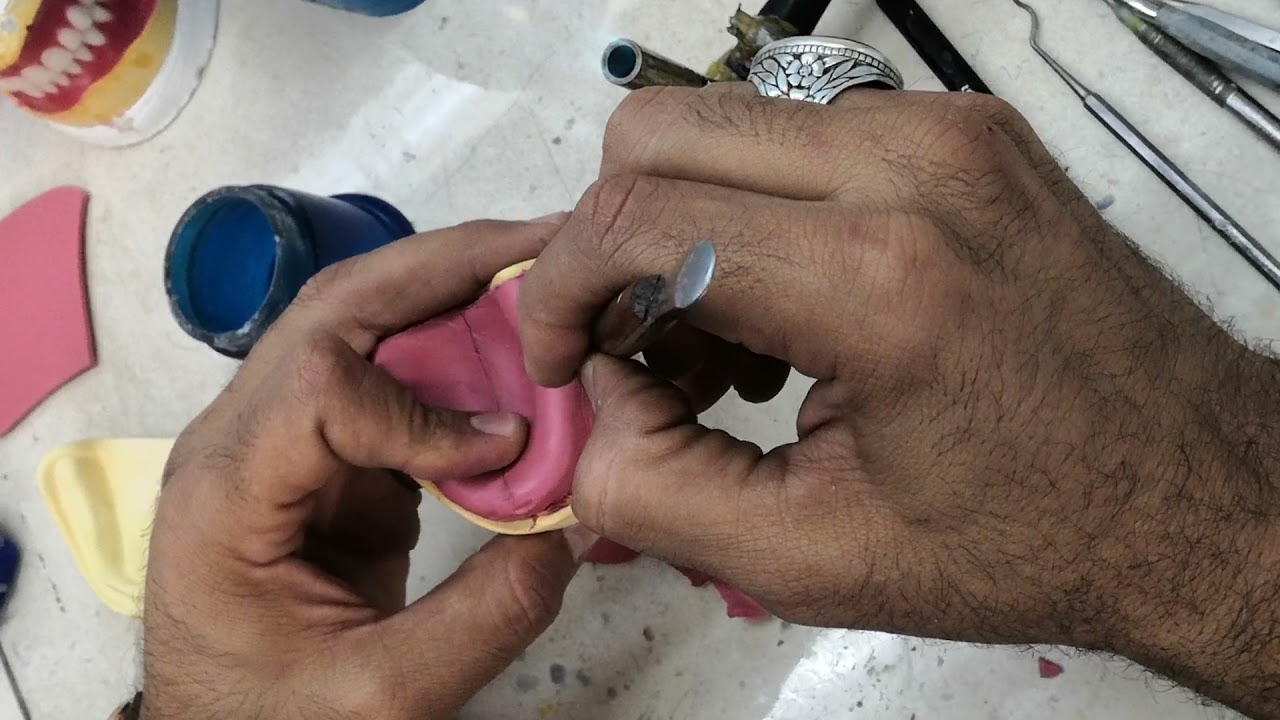 عمل s.tray _ الدكتور مدحت عماوي