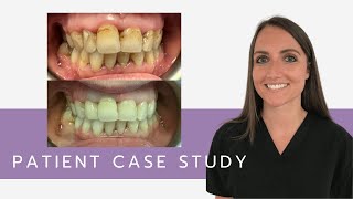Patient Case Study With Jane