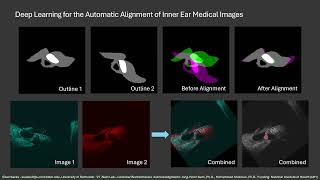 Deep Learning for the Auto Alignment and Outlining of Inner Ear Medical Images