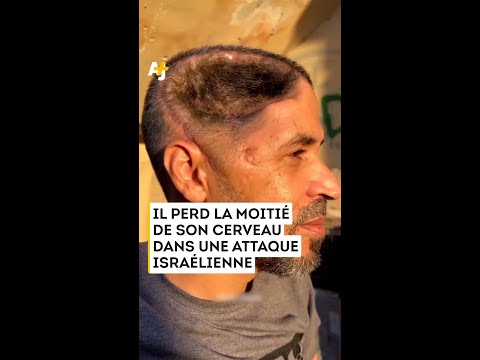 فقد عقبه في هجوم إسرائيلي
