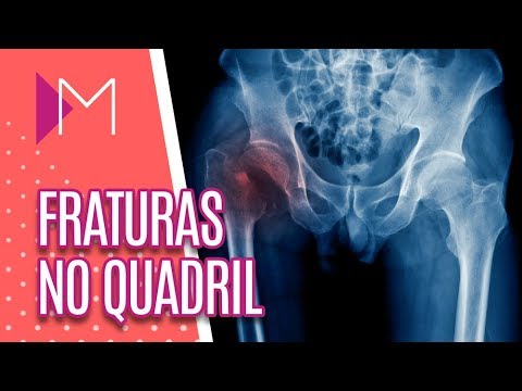 Vídeo: Contusão: Fotos, Tipos, Sintomas E Causas