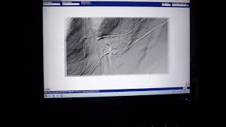 How to Use PA LIDAR