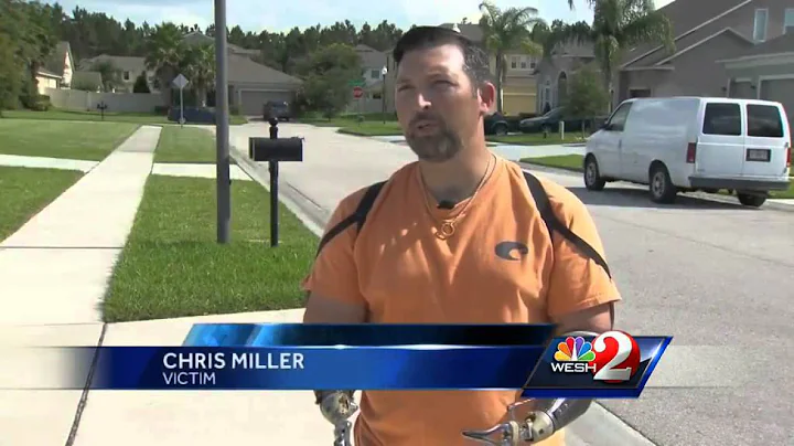 Man's prosthetic arms stolen when thief takes truck