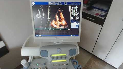 Vivid 7 CW shut down camrec