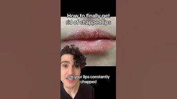 Dermatologist: how to finally fix chapped lips #chappedlips #lipcare #lipcareroutine #dermatologist