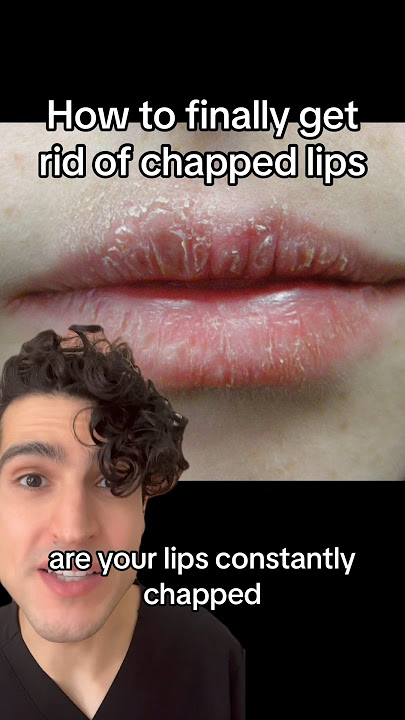 Dermatologist: how to finally fix chapped lips #chappedlips #lipcare #lipcareroutine #dermatologist
