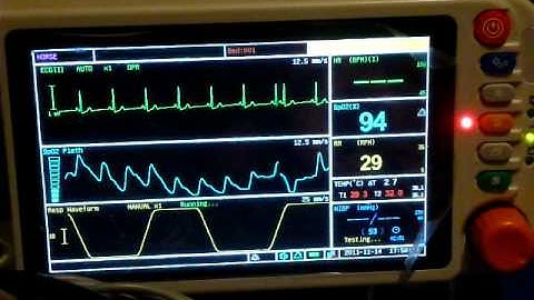 Vetsens Multi Parameter Monitor