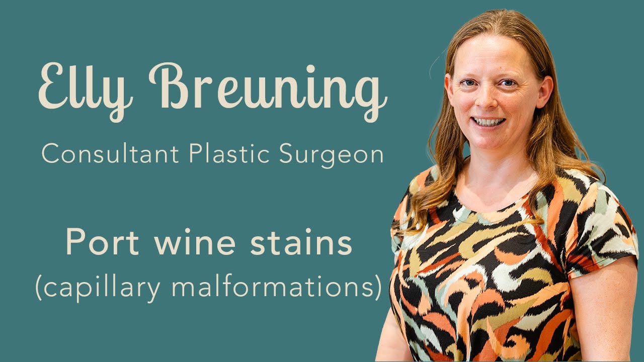 Port wine stains (capillary malformations) with Ms Elly Breuning