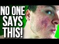 5 ACCUTANE TIPS YOU NEED TO KNOW!