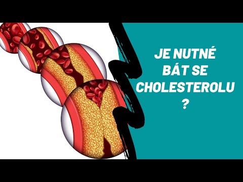 Video: Proč je u žen vysoký cholesterol v krvi?