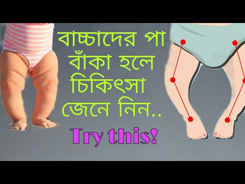 ভিডিও: বাচ্চাদের মধ্যে বাত চিকিত্সা কিভাবে