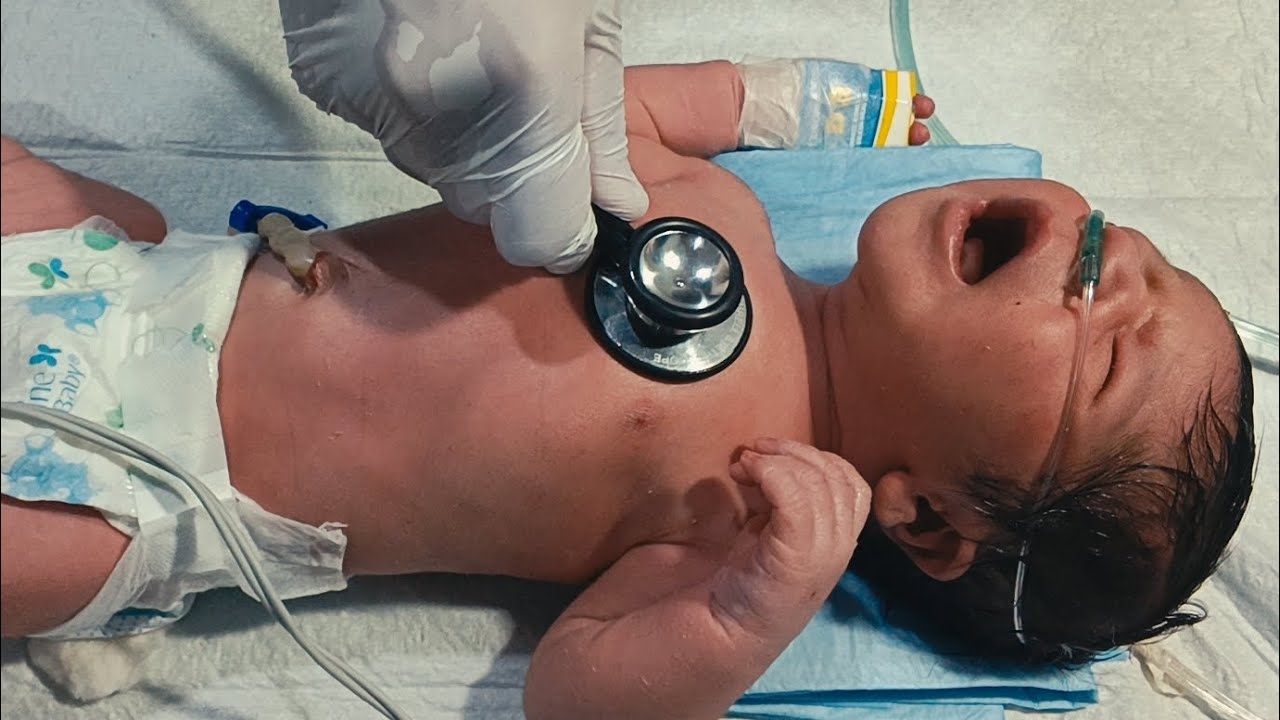 Newborn Baby Critical Case | Birth Asphyxia, Seizures & NICU Care
