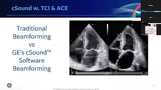 ACE 4D Interventional Echo Webinar - PASCAR 16-06-2022