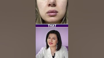 Swelling After Lip Filler