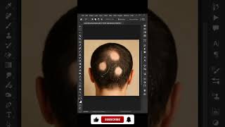 How to Fix AlopeciaBald Spots in Photoshop in 1 Minute!
