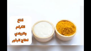 قناع الكركم والزبادي لعلاج البثورTurmeric and yogurt mask for pimples