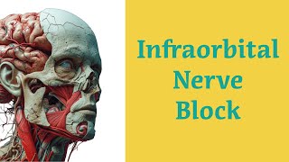 Infraorbital Nerve Block Procedure